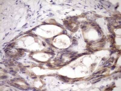 Immunohistochemistry: MCEE Antibody (OTI1B5) [NBP2-45772]