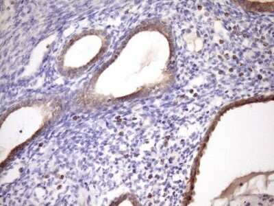 Immunohistochemistry: MCEE Antibody (OTI1B5) [NBP2-45772]
