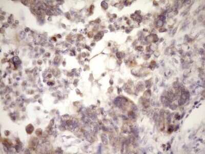 Immunohistochemistry: MCEE Antibody (OTI1B5) [NBP2-45772]