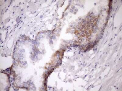 Immunohistochemistry: MCEE Antibody (OTI1B5) [NBP2-45772]