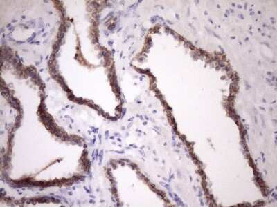 Immunohistochemistry: MCEE Antibody (OTI1B5) [NBP2-45772]