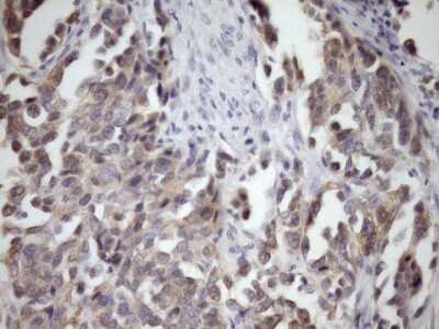Immunohistochemistry: MCEE Antibody (OTI1B5) [NBP2-45772]