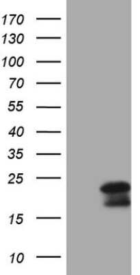 Western Blot: MCEE Antibody (OTI1B5) [NBP2-45772]