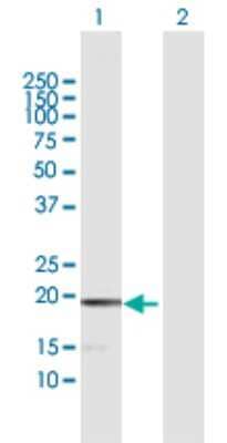 Western Blot: MCEE Antibody [H00084693-D01P]