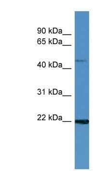 Western Blot: MCEE Antibody [NBP1-79808]