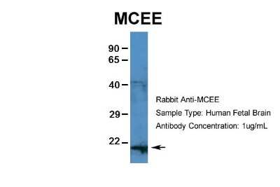Western Blot: MCEE Antibody [NBP1-79808]