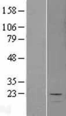 Western Blot: MCEE Overexpression Lysate [NBL1-12946]