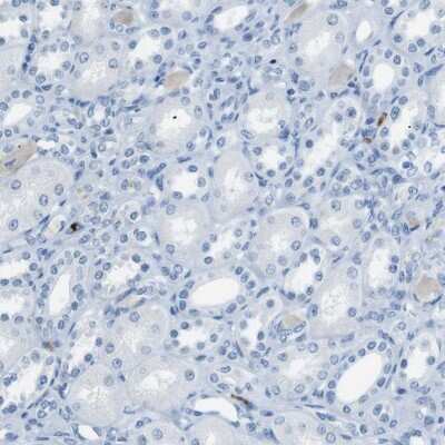 Immunohistochemistry-Paraffin: MCEMP1 Antibody [NBP1-81253]