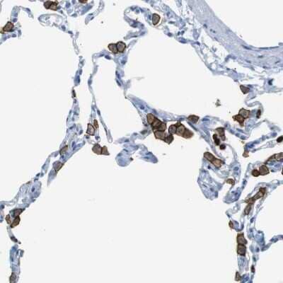 Immunohistochemistry-Paraffin: MCEMP1 Antibody [NBP1-81253]