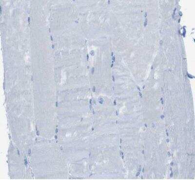 Immunohistochemistry-Paraffin: MCEMP1 Antibody [NBP1-81253]