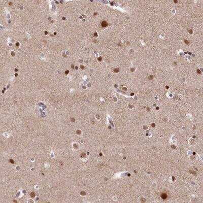 Immunohistochemistry: MCF2L2 Antibody [NBP1-90851]