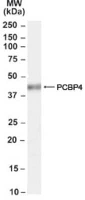 Western Blot: MCG10 Antibody [NB100-68152]