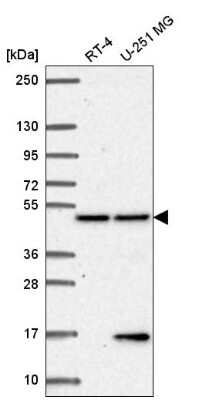 Western Blot: MCG10 Antibody [NBP2-55526]