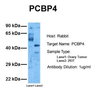 Western Blot: MCG10 Antibody [NBP2-87790]