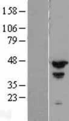 Western Blot: MCG10 Overexpression Lysate [NBP2-05925]