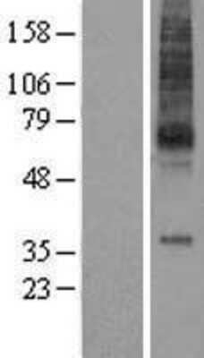 Western Blot: MCHR1 Overexpression Lysate [NBL1-12947]