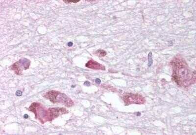 Immunohistochemistry-Paraffin: MCHR1 Antibody - BSA Free [NBP1-02408]