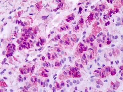 Immunohistochemistry-Paraffin: MCHR1 Antibody - BSA Free [NLS1532]