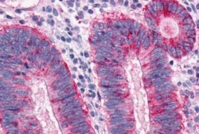 Immunohistochemistry-Paraffin: MCHR1 Antibody - BSA Free [NLS1533]