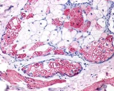 Immunohistochemistry-Paraffin: MCHR1 Antibody - BSA Free [NLS1539]