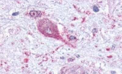 Immunohistochemistry-Paraffin: MCHR1 Antibody - BSA Free [NLS1539]