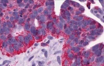Immunohistochemistry-Paraffin: MCHR1 Antibody - BSA Free [NLS1539]