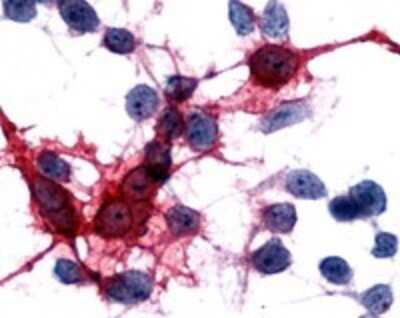 Immunohistochemistry-Paraffin: MCHR2 Antibody - BSA Free [NLS1907]