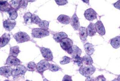 Immunohistochemistry-Paraffin: MCHR2 Antibody - BSA Free [NLS1907]