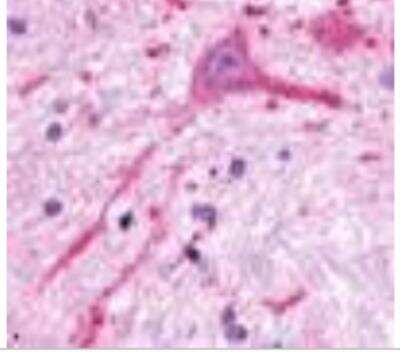 Immunohistochemistry-Paraffin: MCHR2 Antibody - BSA Free [NLS1907]