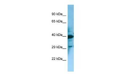 Western Blot: MCHR2 Antibody [NBP2-82281]