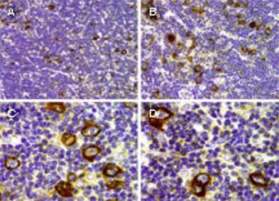 Immunohistochemistry-Paraffin: Mcl-1 Antibody [NB100-56146]