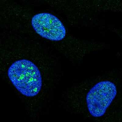 Immunocytochemistry/ Immunofluorescence: MCM10 Antibody [NBP2-57966]