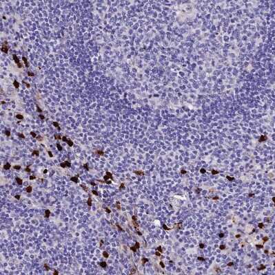 Immunohistochemistry-Paraffin: MCM10 Antibody [NBP1-92102]
