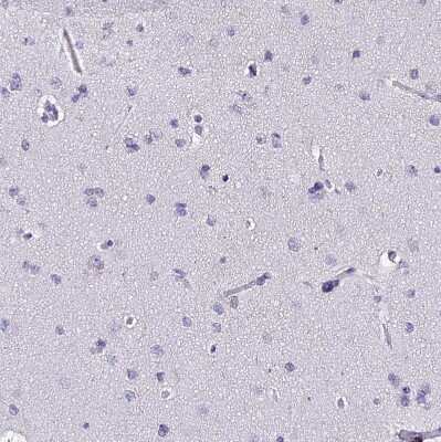 Immunohistochemistry-Paraffin: MCM10 Antibody [NBP1-92102]
