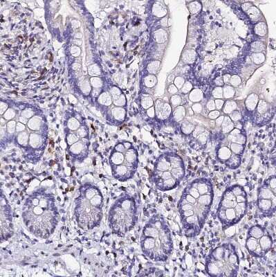 Immunohistochemistry-Paraffin: MCM10 Antibody [NBP1-92102]