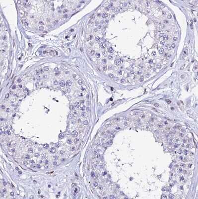 Immunohistochemistry-Paraffin: MCM10 Antibody [NBP1-92102]