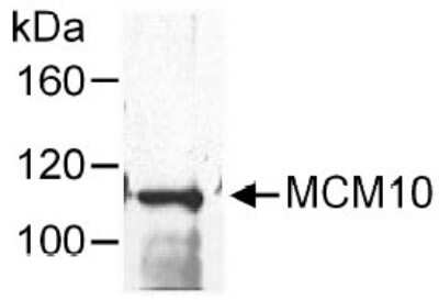 Immunoprecipitation: MCM10 Antibody [NB100-253]