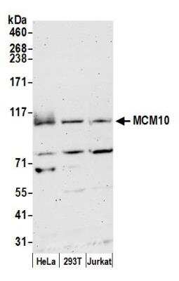 Western Blot: MCM10 Antibody [NB100-253]