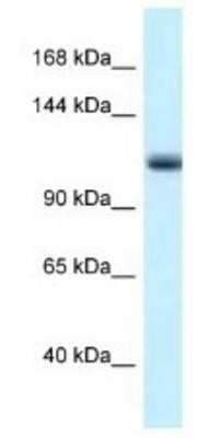 Western Blot: MCM10 Antibody [NBP1-82395]