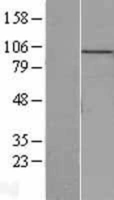 Western Blot: MCM10 Overexpression Lysate [NBL1-12948]