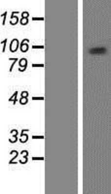 Western Blot: MCM10 Overexpression Lysate [NBP2-10059]