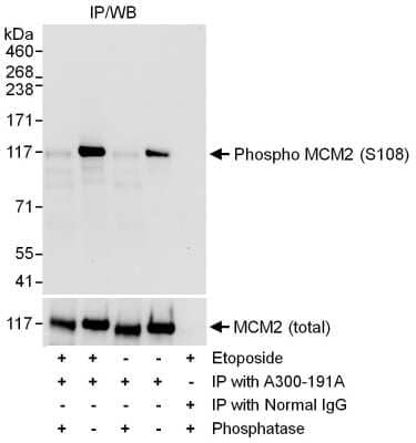 Western Blot: MCM2 [p Ser108] Antibody [NB100-639]