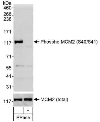 Western Blot: MCM2 [p Ser41] Antibody [NB100-2569]