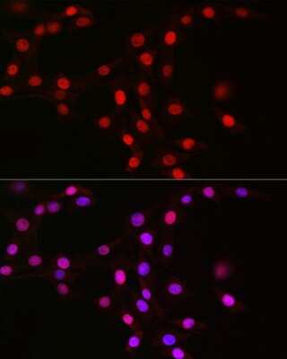 Immunocytochemistry/ Immunofluorescence: MCM2 Antibody (0Q10S9) [NBP3-16066]