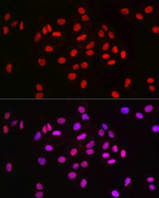 Immunocytochemistry/ Immunofluorescence: MCM2 Antibody (0Q10S9) [NBP3-16066]