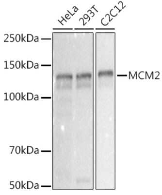 Western Blot: MCM2 Antibody (0Q10S9) [NBP3-16066]