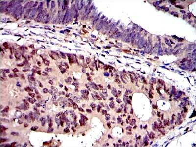 Immunohistochemistry: MCM2 Antibody (2B3) - BSA Free [NBP2-37566]