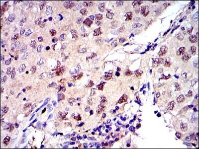Immunohistochemistry: MCM2 Antibody (2B3) - BSA Free [NBP2-37566]