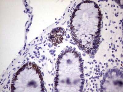 Immunohistochemistry: MCM2 Antibody (OTI3C12) [NBP2-45774]