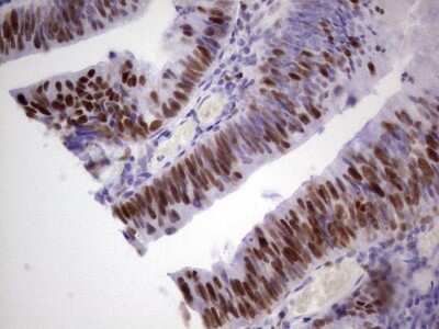 Immunohistochemistry: MCM2 Antibody (OTI3C12) [NBP2-45774]